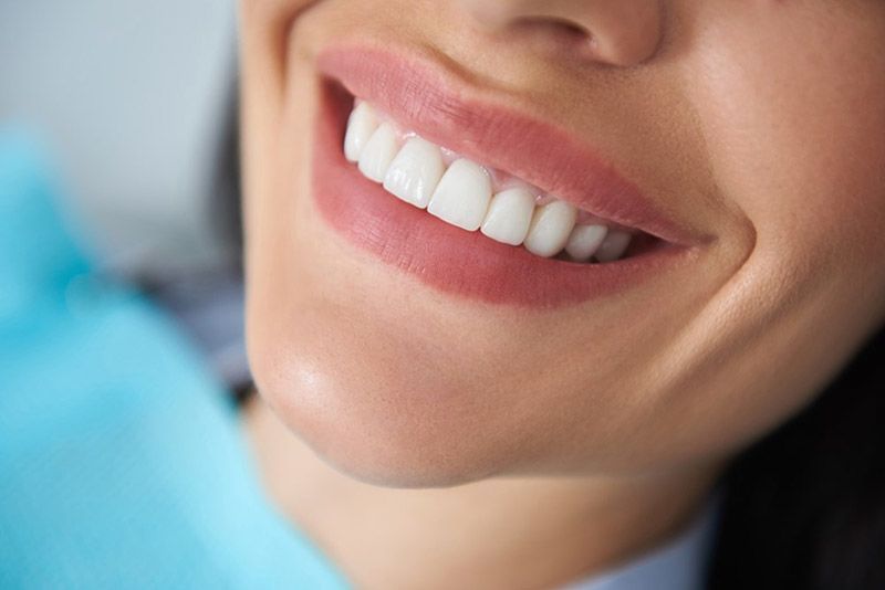 Tooth Whitening in Spruce Grove
