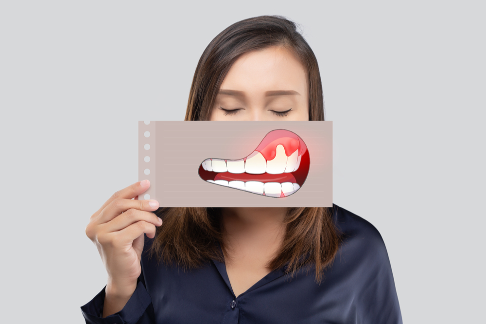 what are the types of gum disease