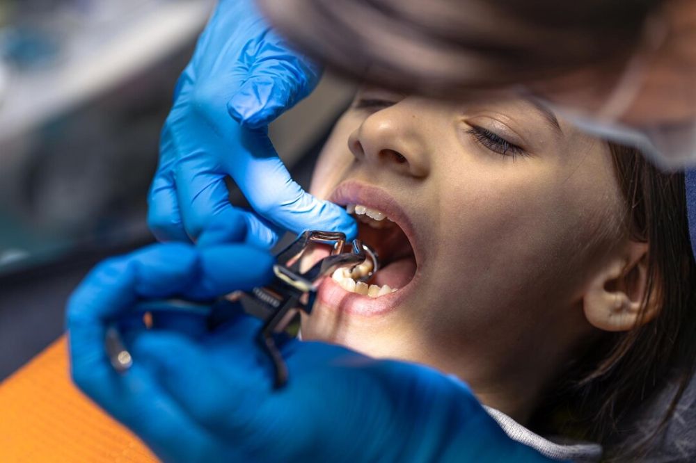 can dental bridges break or crack over time